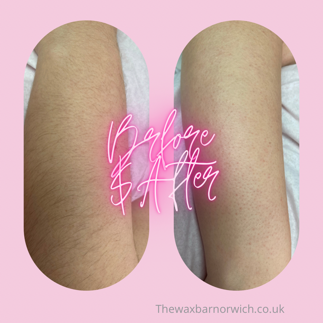 Smooth arms for summer! 💪🏻​​​​​​​​
​​​​​​​​
Forearm wax // £13​​​​​​​​
Full arm wax // £20